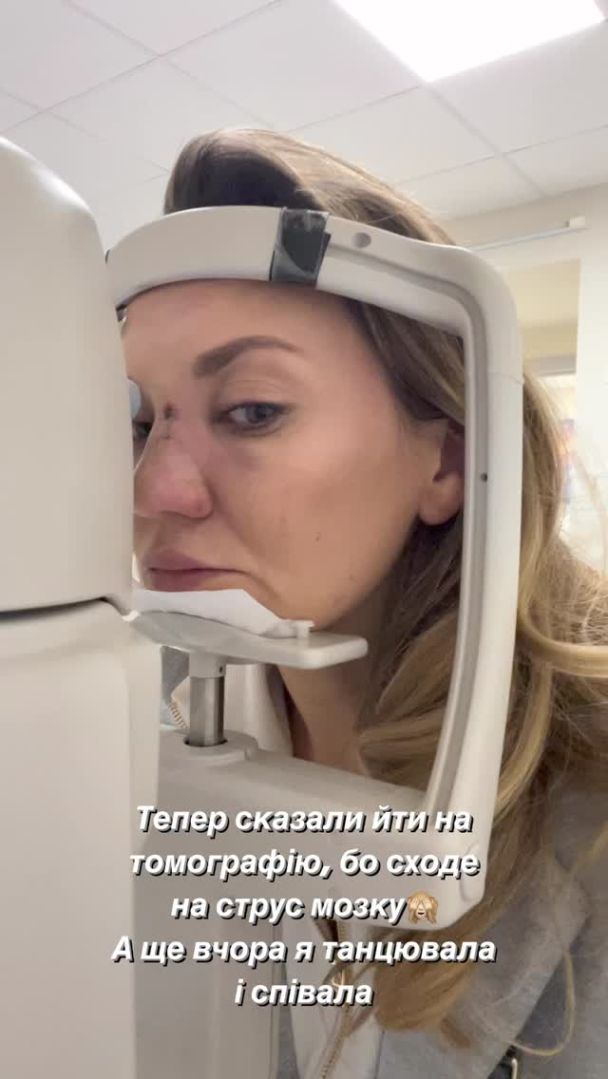 Звезда "Квартала 95" Саливанчук ужаснула фото после перелома носа и сотрясения мозга