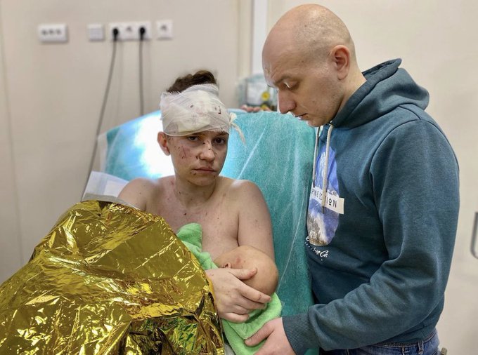 Украинская Мадонна: в Киеве мать спасла ребенка, закрыв его своим телом от обстрелов