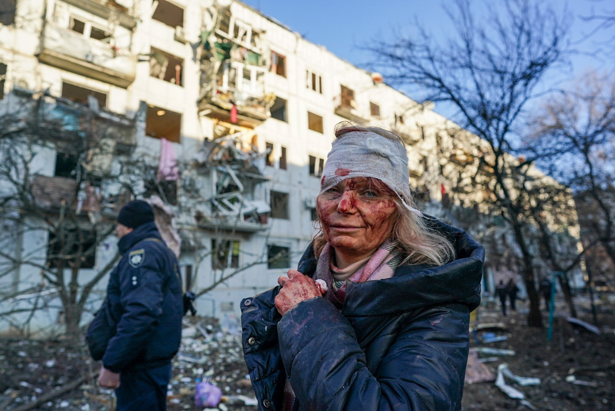 Портрет раненой учительницы из Чугаева продали за 100 тысяч долларов: эти деньги помогут украинцам