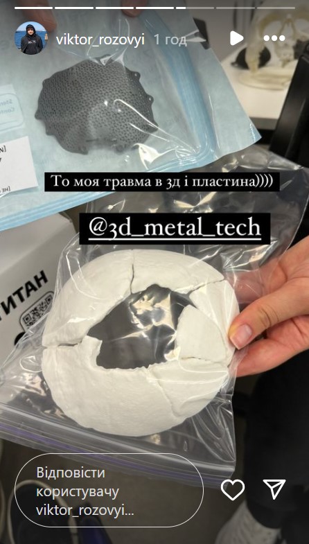 Комік Віктор Розовий розкрив подробиці реабілітації та пригадав бій перед пораненням (фото)