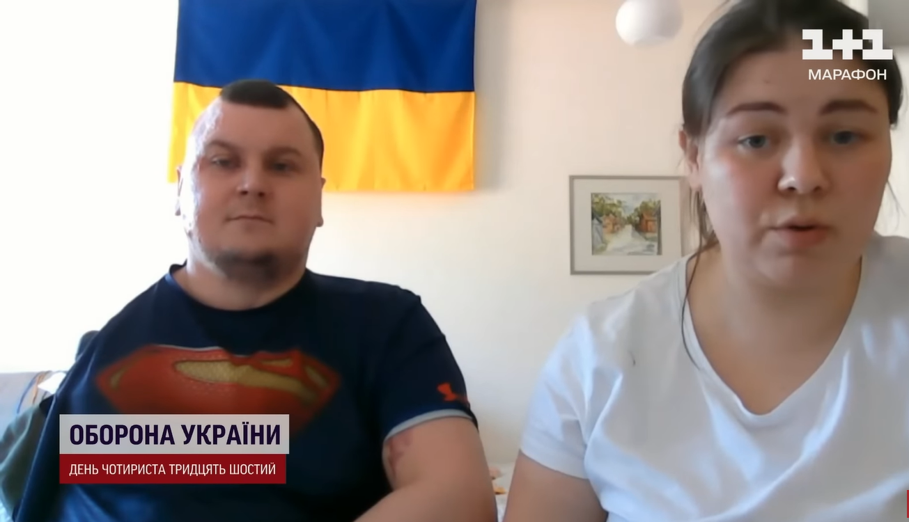"Боялися, що розсиплеться": лікарі врятували бійця ЗСУ з опіками, для яких немає класифікації