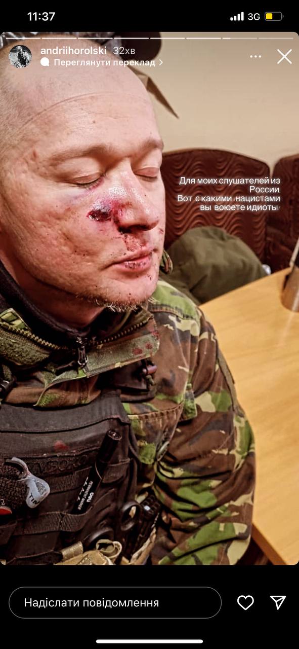 Андрій Хливнюк потрапив під мінометний обстріл: його поранено