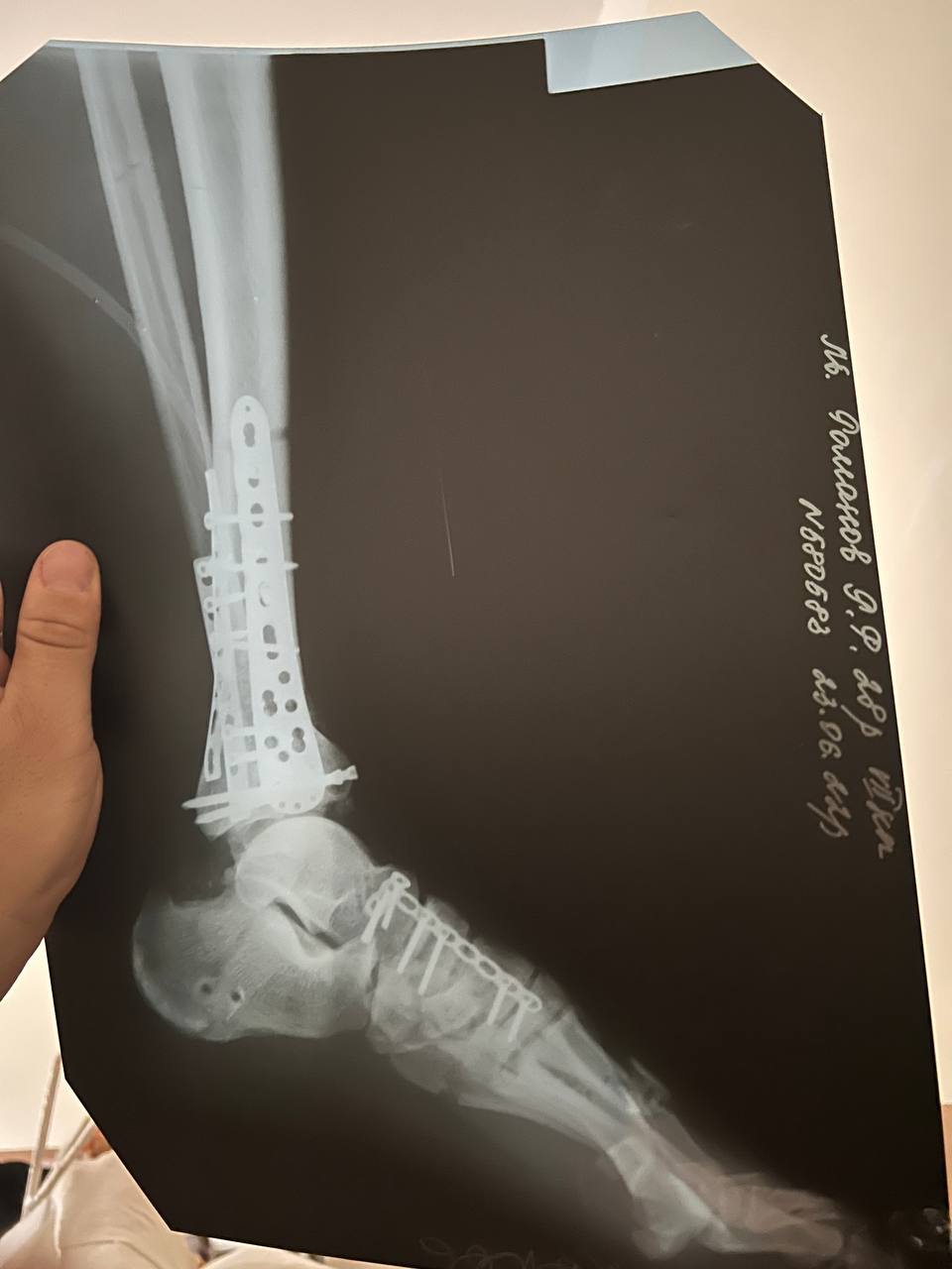 "Россия хочет, чтобы мы все покинули родную страну и забыли свою историю". Доброволец ВСУ чудом выжил после ранения