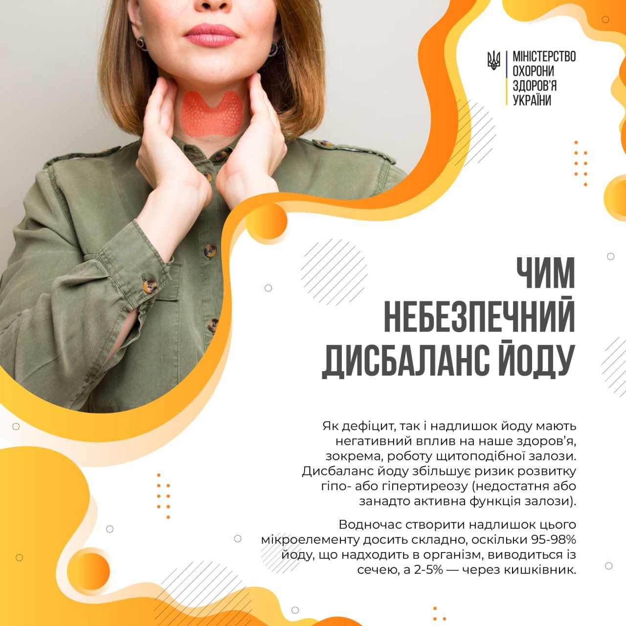 Кому нужно следить за уровнем йода в организме: в Минздраве назвали категории украинцев