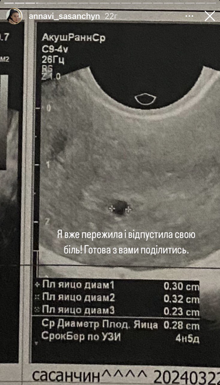 "Болело все": жена Романа Сасанчина заявила о трагической потере